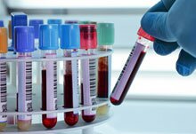 Lymphozyten-Erkrankungen Übersicht