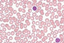 Lymphozytenzahl